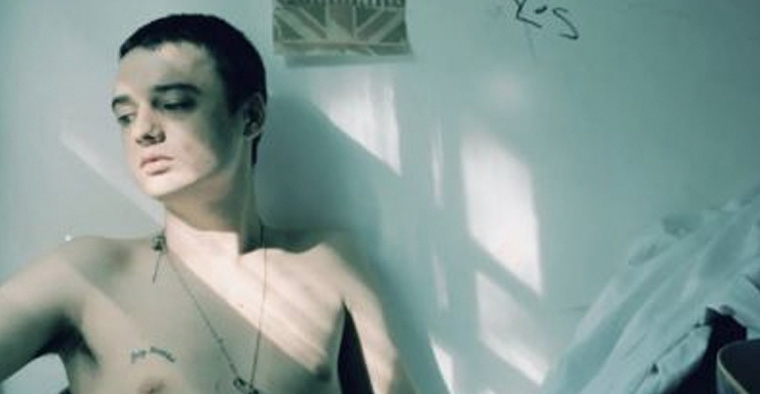 PETER DOHERTY